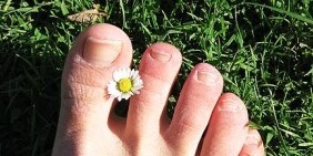 Hongos en las uñas de los pies