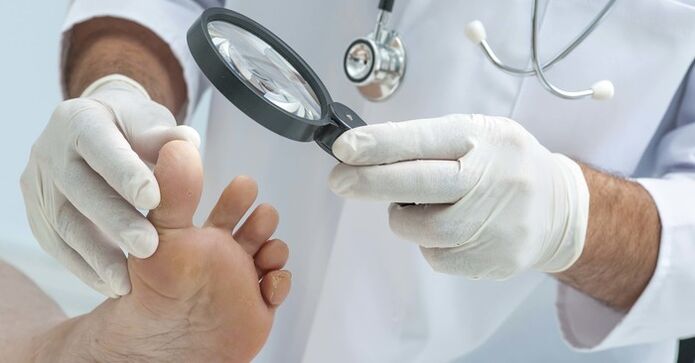 Examen de diagnóstico de las uñas de los pies. 