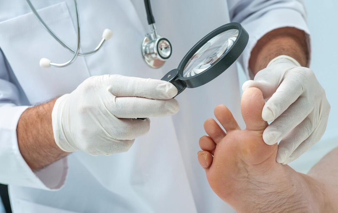 el doctor examina los pies con hongos