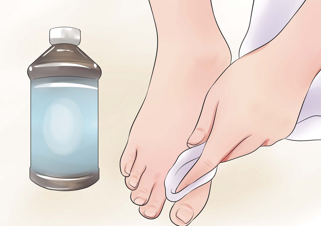 agua oxigenada para hongos en las uñas de los pies